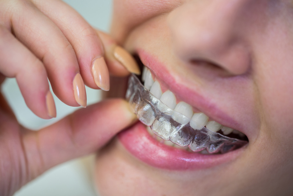 protheses orthodontique